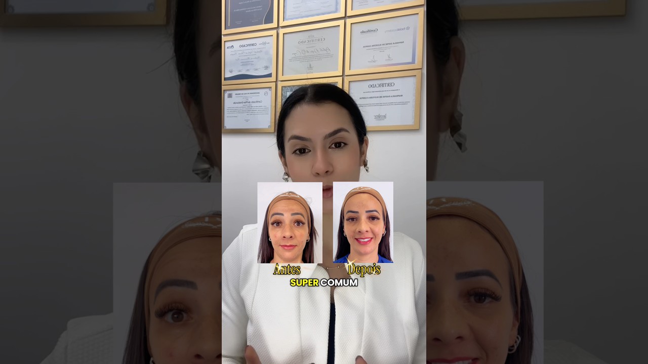 👉 Me conta: Você já teve esse medo de ficar com a expressão congelada?