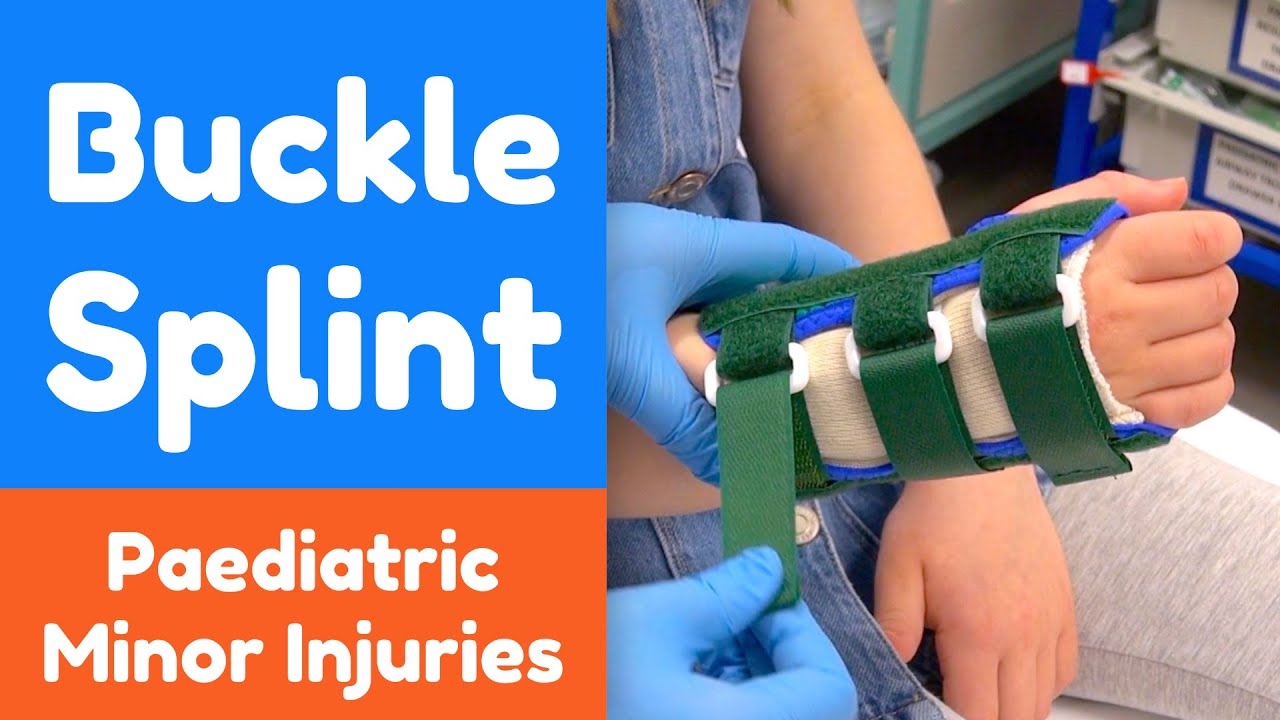 How to apply a Buckle Splint for a child