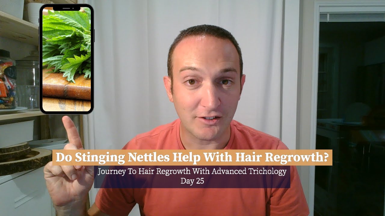 Do Stinging Nettles Help With Hair Regrowth? Day 25 Journey  with Advanced Trichology