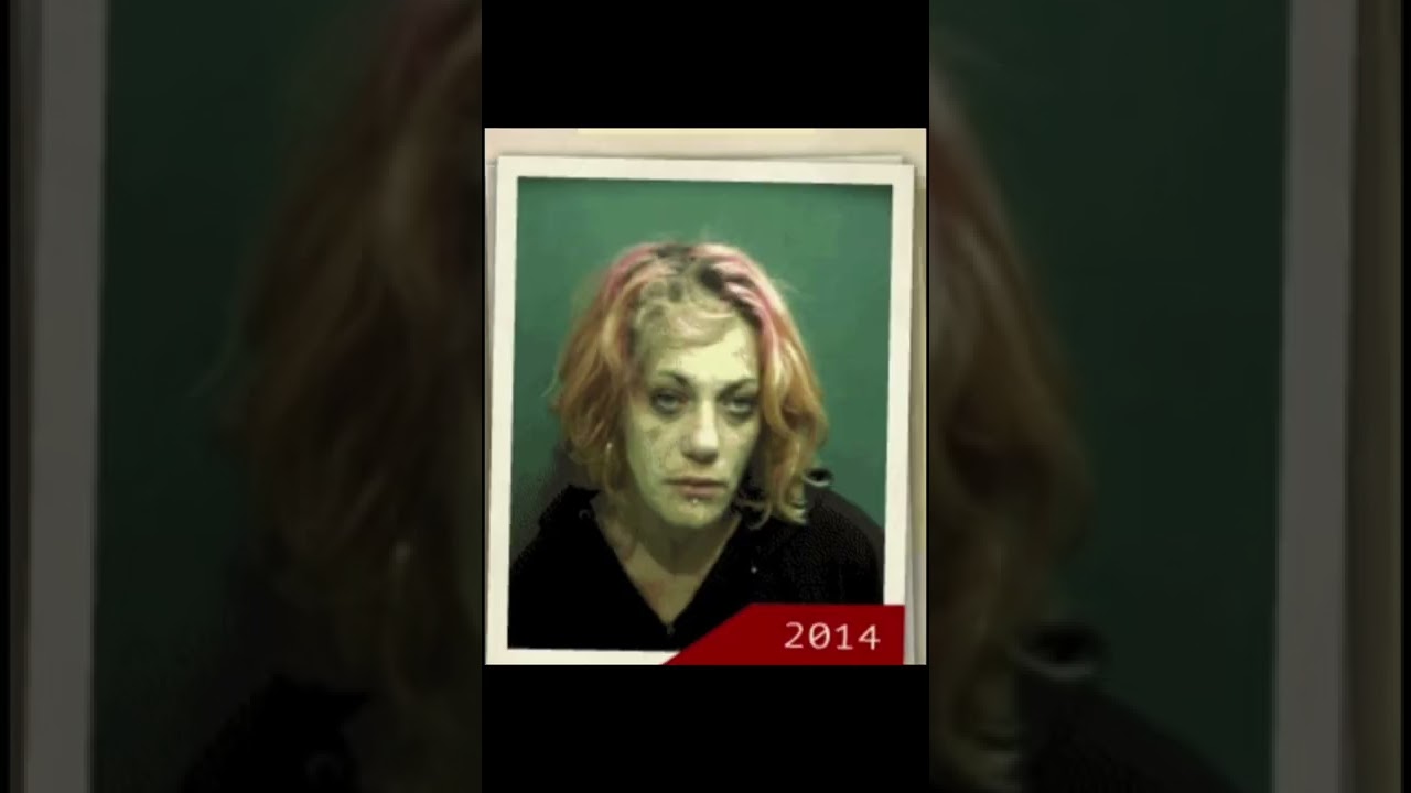 People Before And After Drugs 💊 #shorts