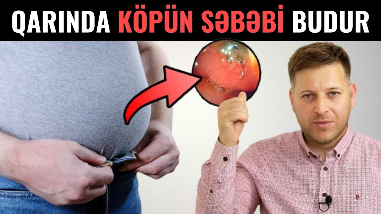 Mədədə Köp Buna Görə Yaranırmış...