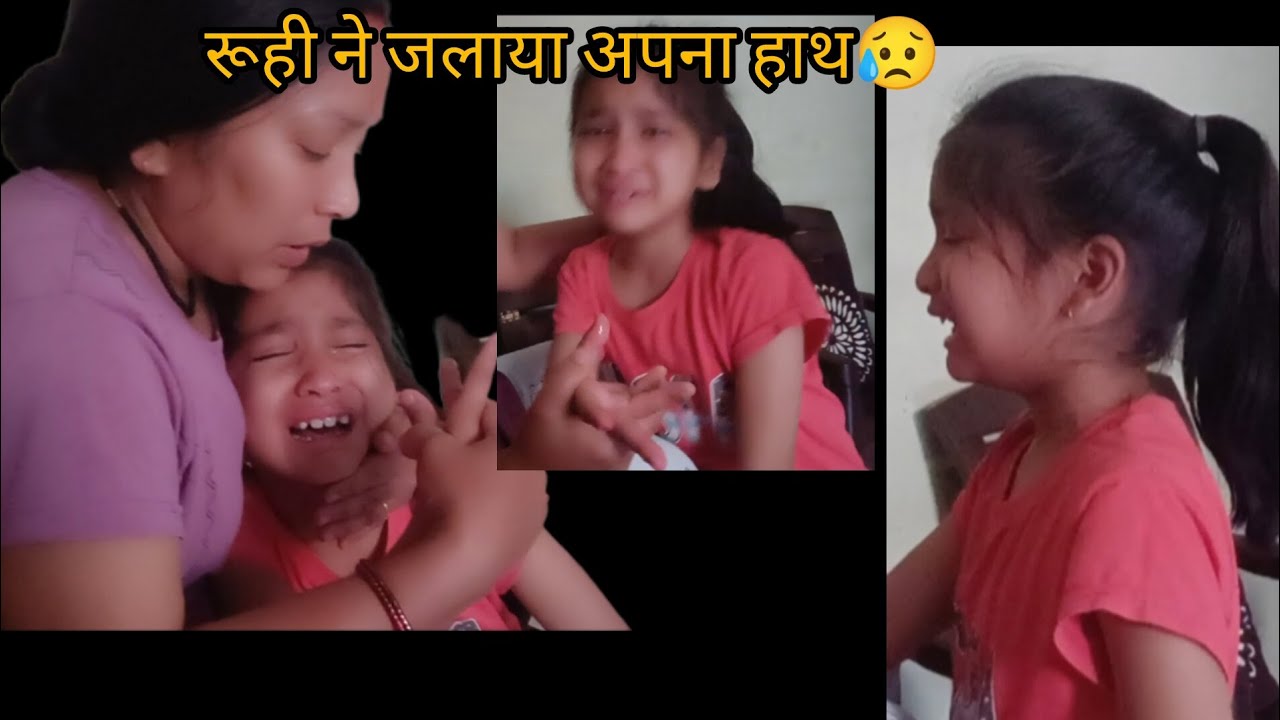 रूही ने जलाया अपना हाथ😥😥