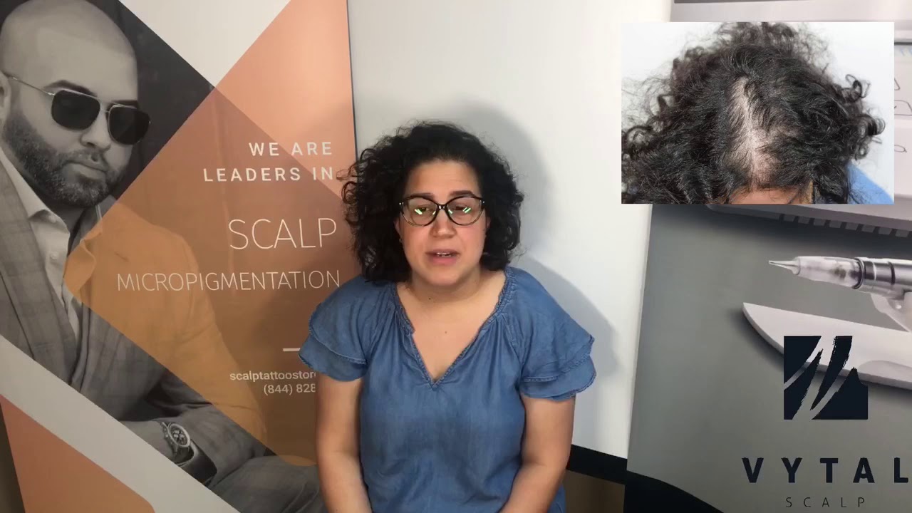 SMP Scalp Micropigmentation for Women