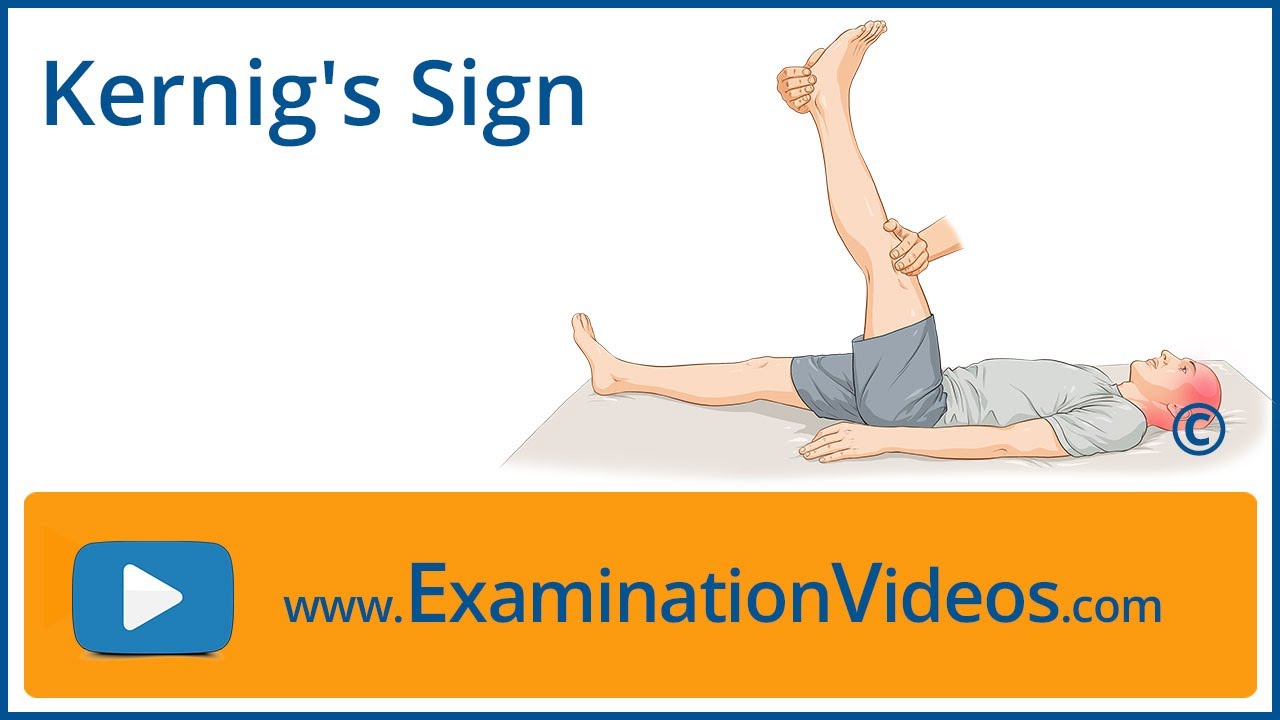 Kernig's Sign