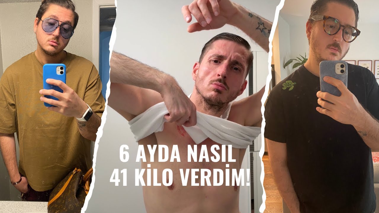Nasıl 6 Ayda 41 Kilo Verdim? | Zayıflama Yolculuğum