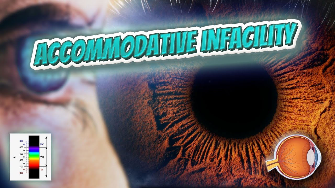 Accommodative infacility - Your EYEBALLS - EYNTK 👁️💉😳💊🔊💯✅
