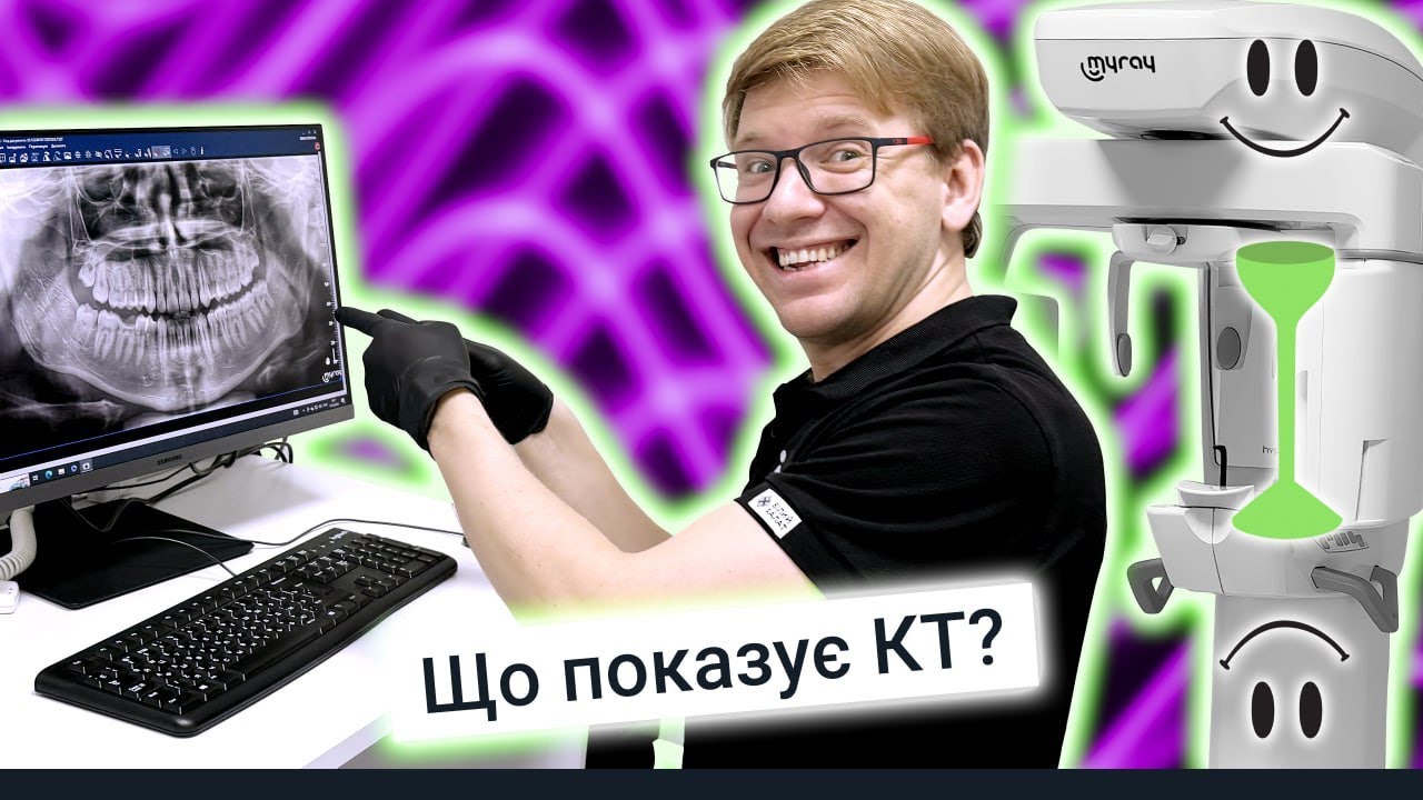 Що показує КТ? 💚Сучасні медоти діагностики в стоматології #DrNychyporchuk_clinic #toothless #smile