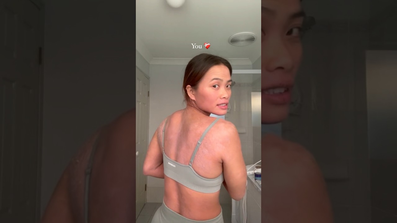 Dupixent has CHANGED MY LIFE ❤️&zwj;🩹 #eczema #skincare #sarahmagusara #shorts