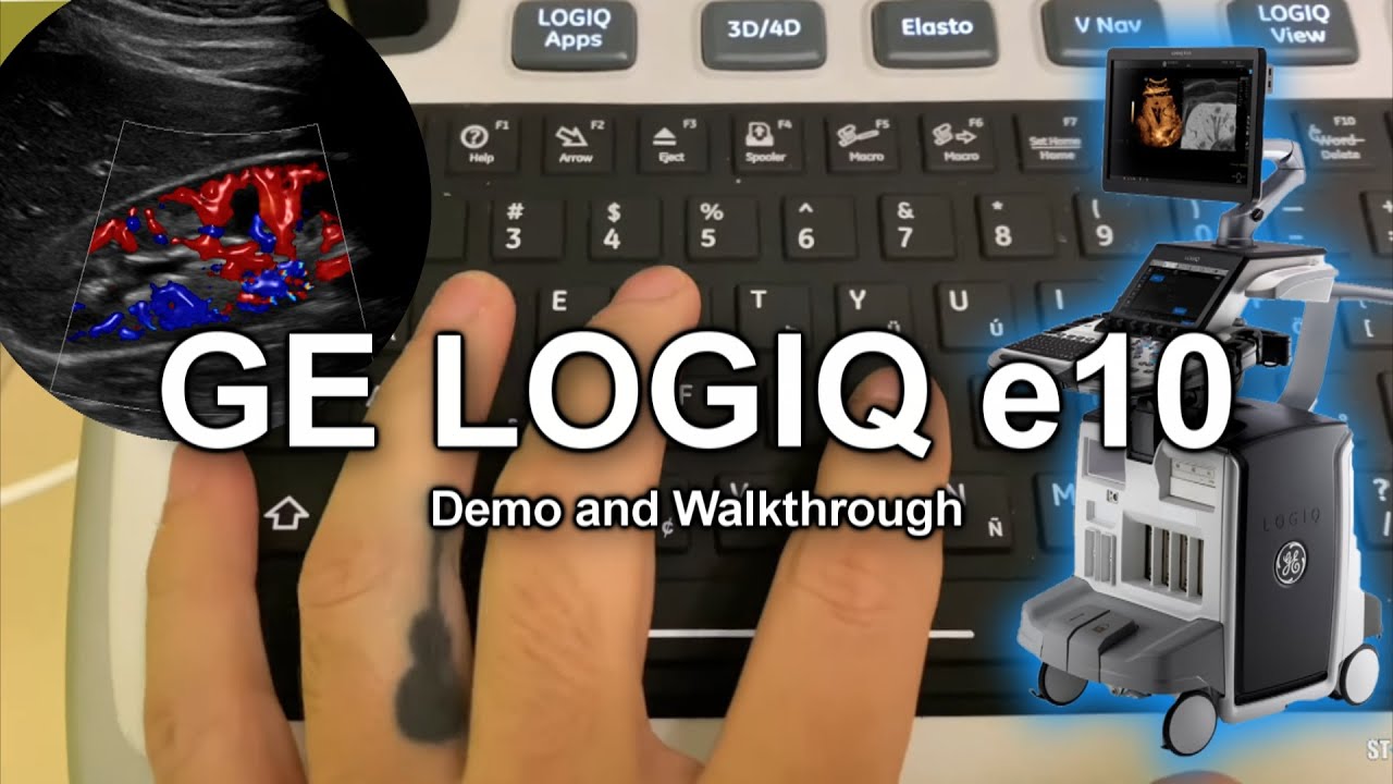 New GE logiq e10 demo!