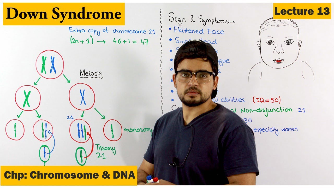 Down's Syndrome | A Genetic Disorder | Lecture 13