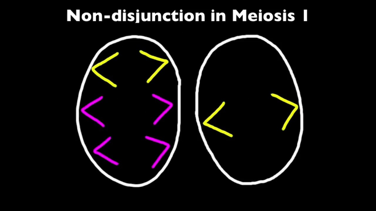 3.3 Non-disjunction and Down Syndrome