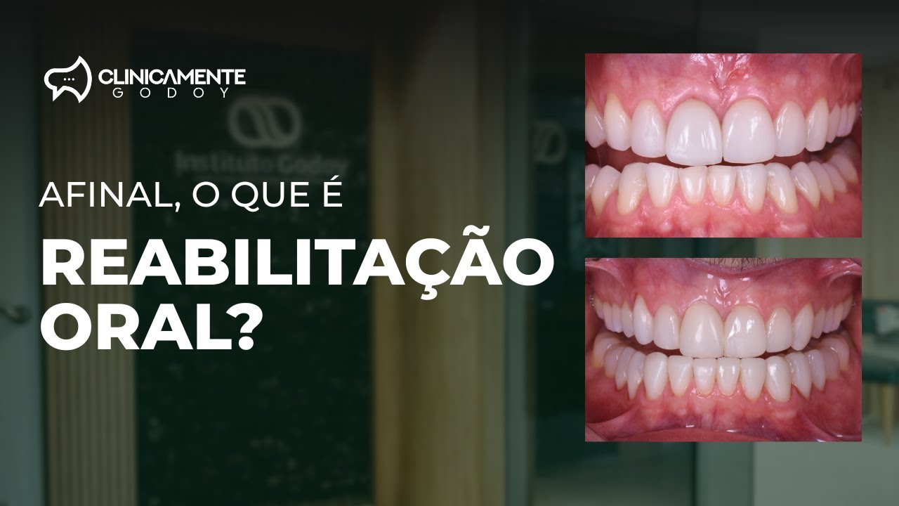 Afinal, o que é reabilitação oral?!