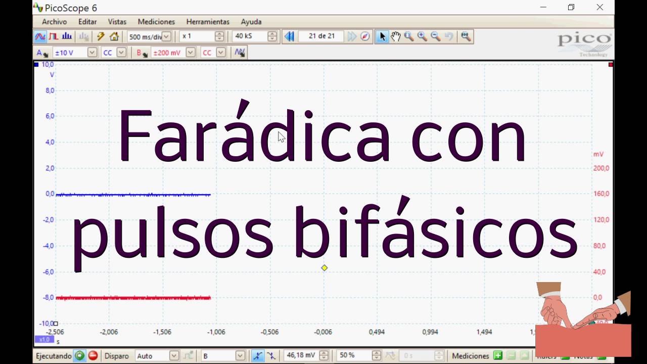 Formas de onda en electroterapia007 - farádicas