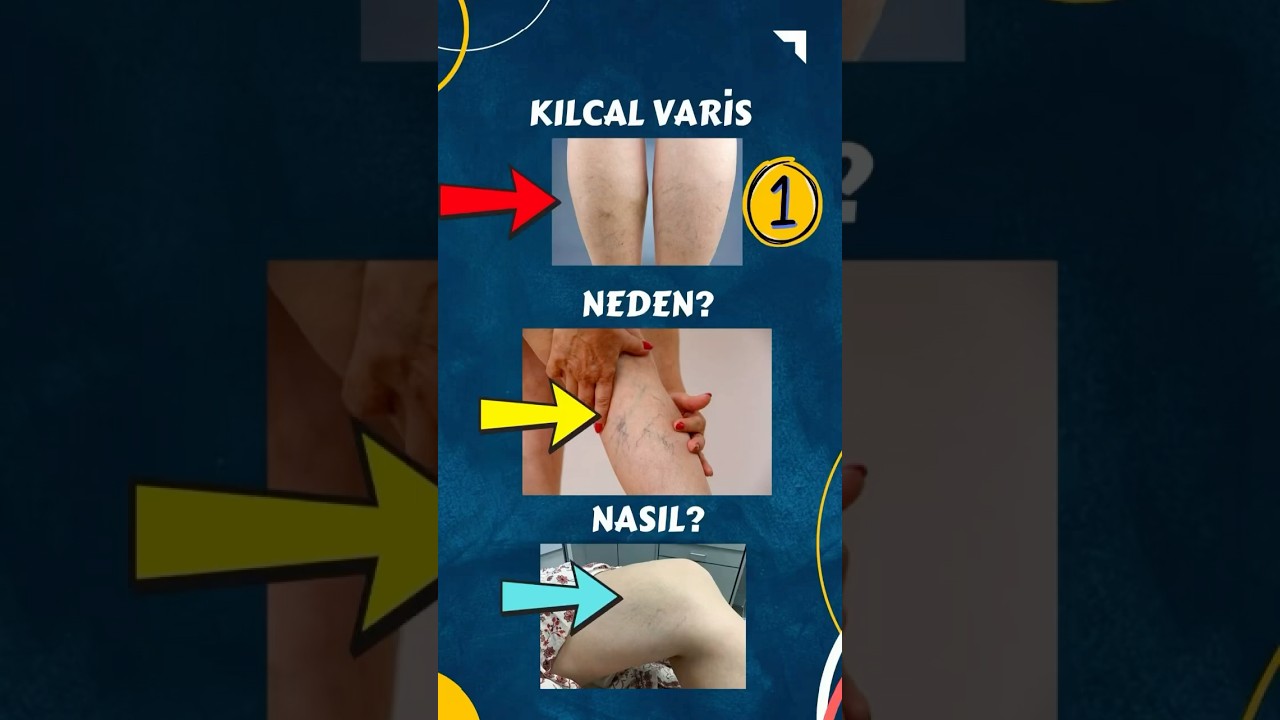Varis: Nedenleri ,  Bilmeniz Gereken Her Şey, Serdar Akg&uuml;n, Sağlık Videoları