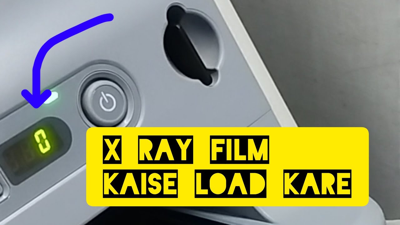 x ray film kaise load kre in hindi | how to load x ray film | fuji printer me x ray film kaise load