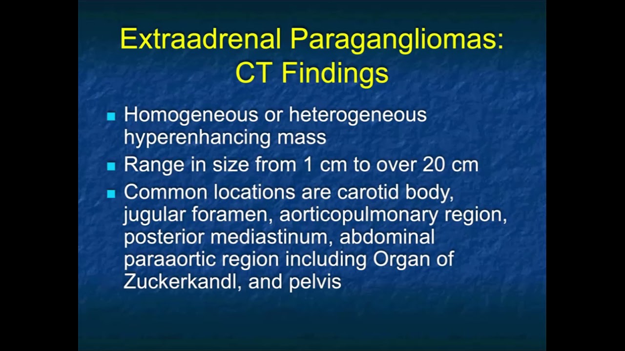 The Many Faces of Adrenal Pheochromocytoma: What You Need to Know - Part 1