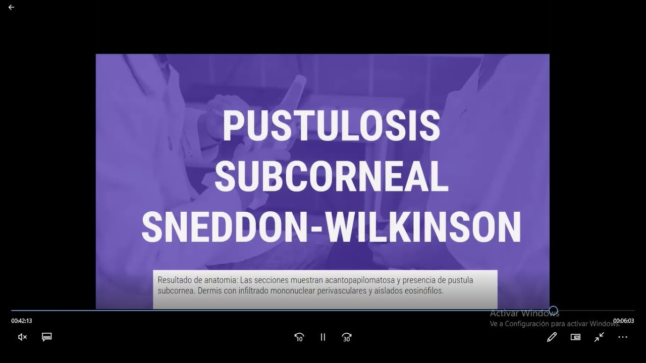 Pustulosis Subcorneal Sneddon-Wilkinson. Dr. Ortiz