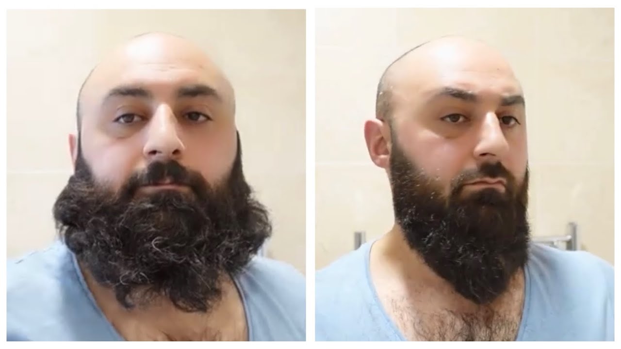 Huge Beard Trim ASMR Clipper Barber Turko