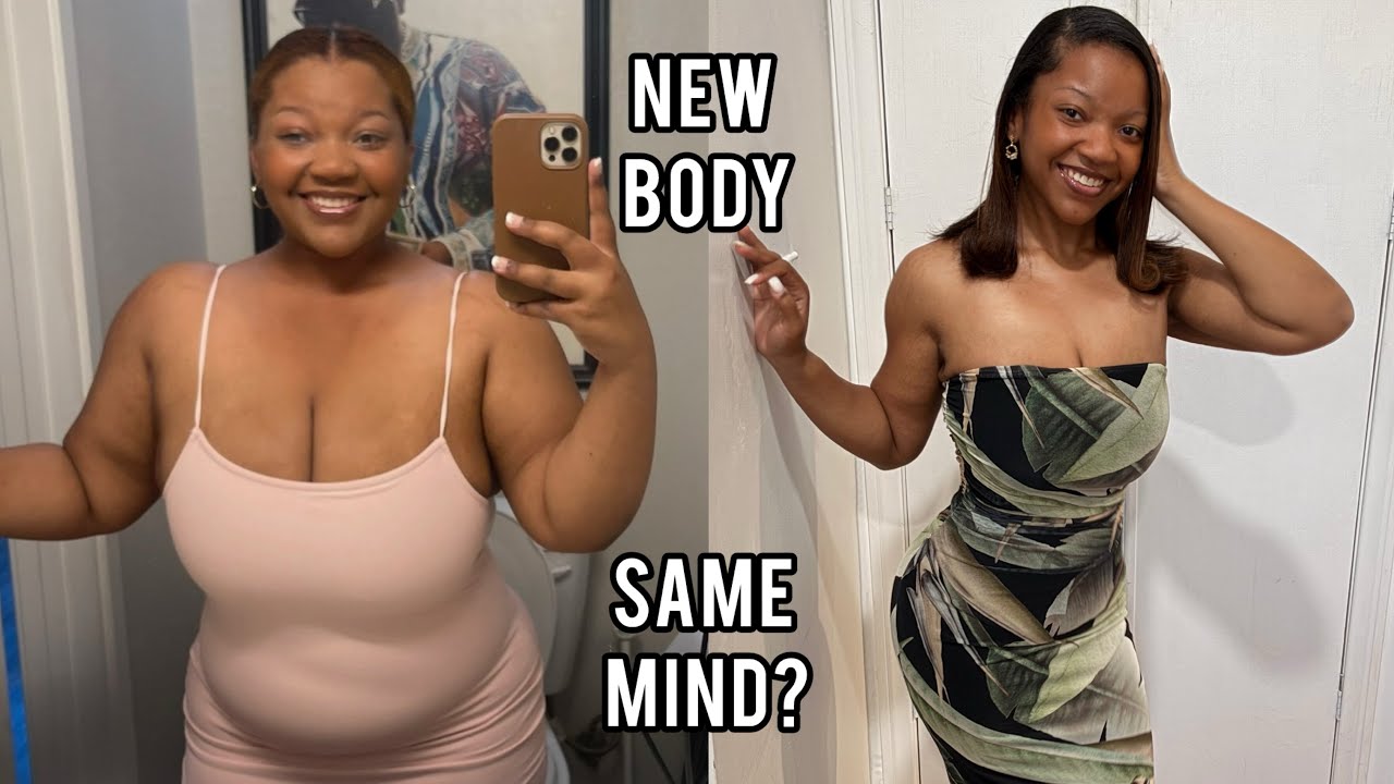 What Losing 160 Pounds Didn’t Fix