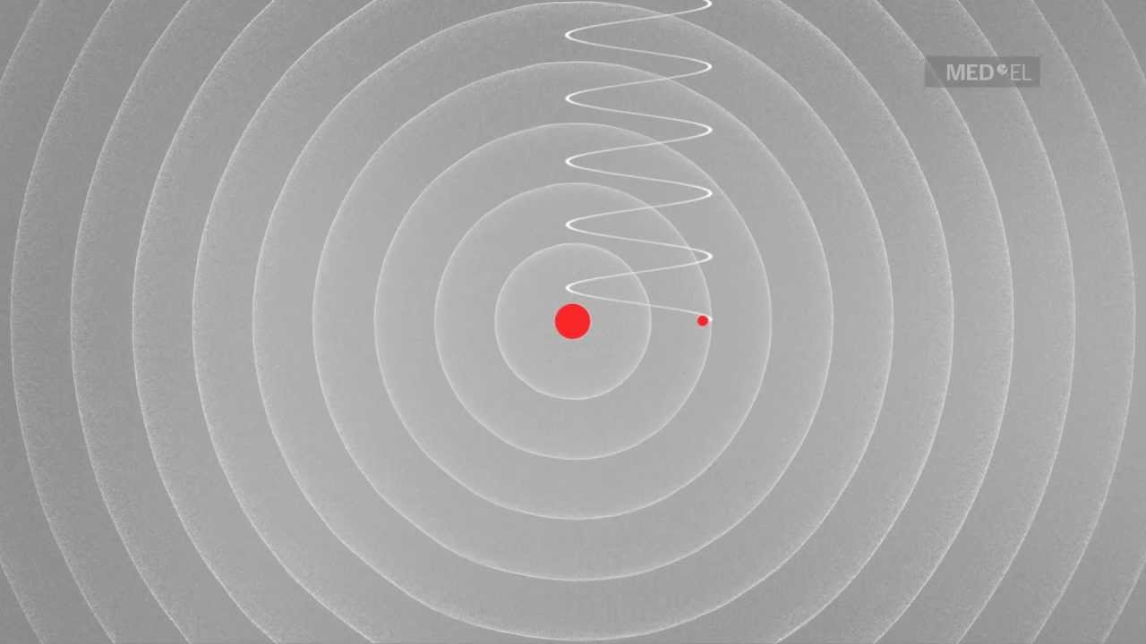 Understanding Sound Waves | MED-EL