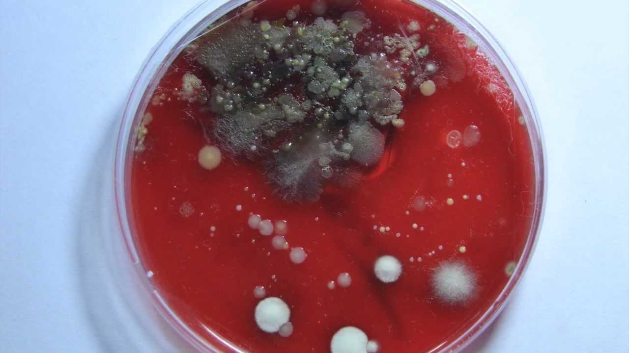 Bacteria Growth Time Lapse