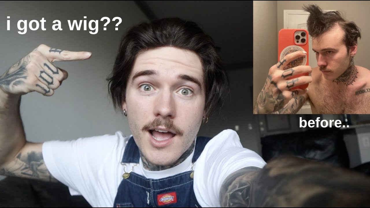 why i got a hair system... my hair loss journey