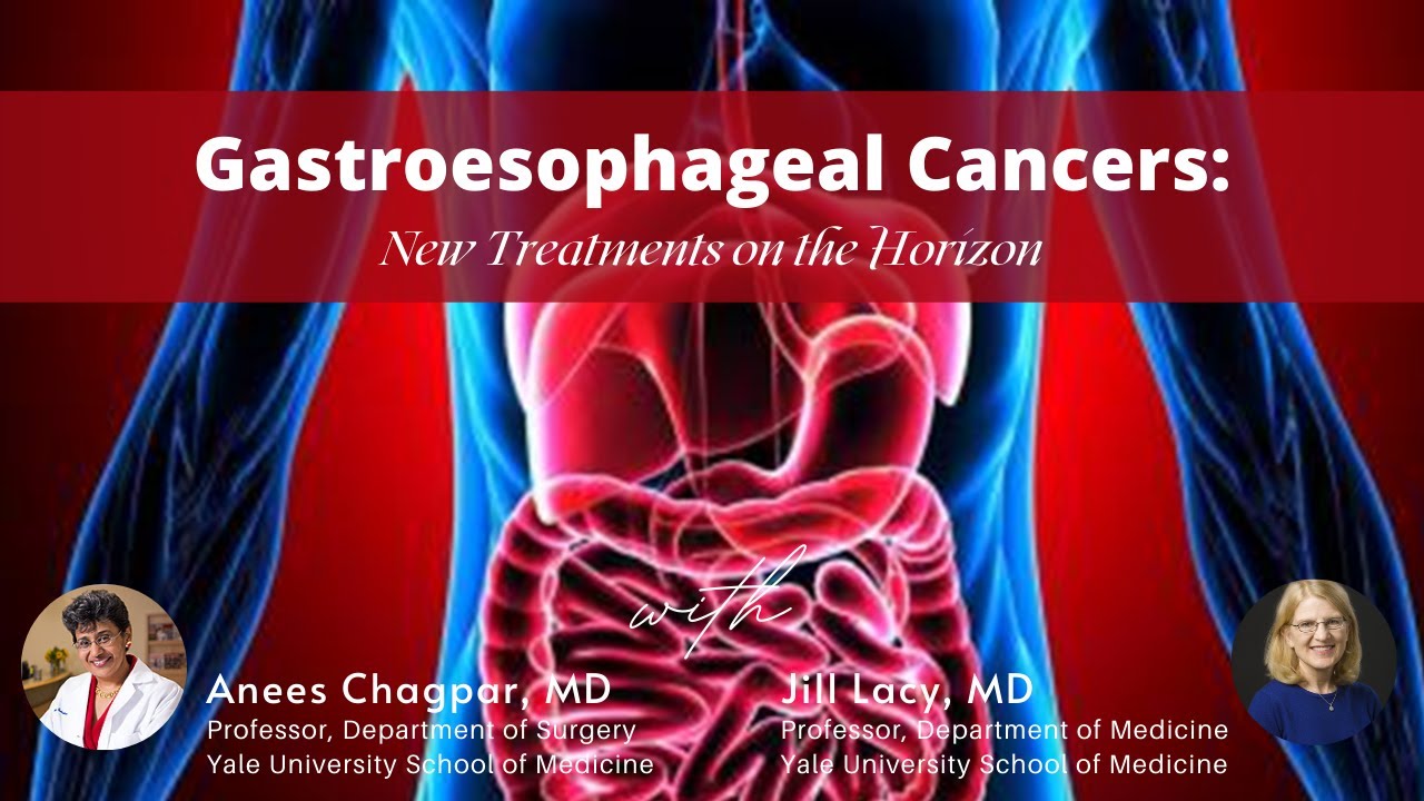 GASTROESOPHAGEAL CANCER:  New therapies on the horizon