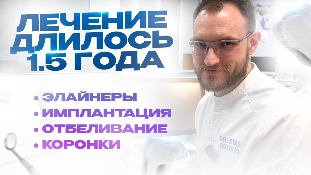 Лечили 1.5 года и не вылечили... Удалили 8 зубы, сделали импланты, коронки, элайнеры, отбеливание)