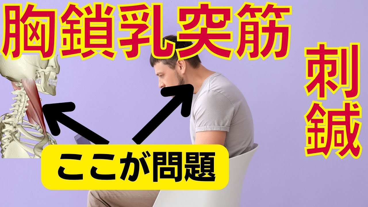 胸鎖乳突筋への摘み押手の刺鍼｜上位交差性症候群などに
