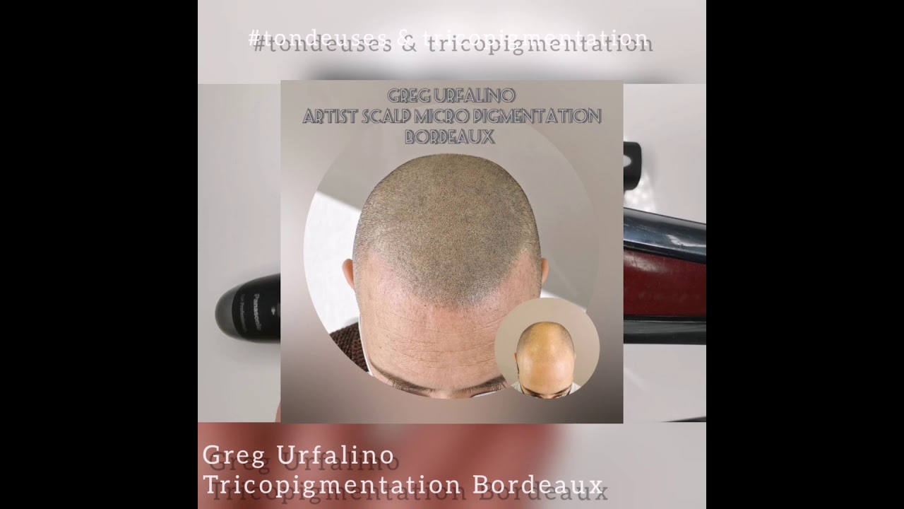 Tondeuses et tricopigmentation