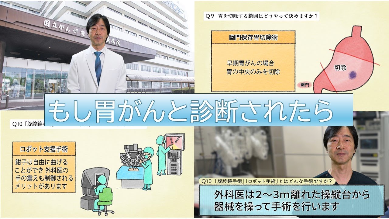 あなたやあなたの大切な方がもし胃がんと診断されたら【国立がん研究センター東病院】