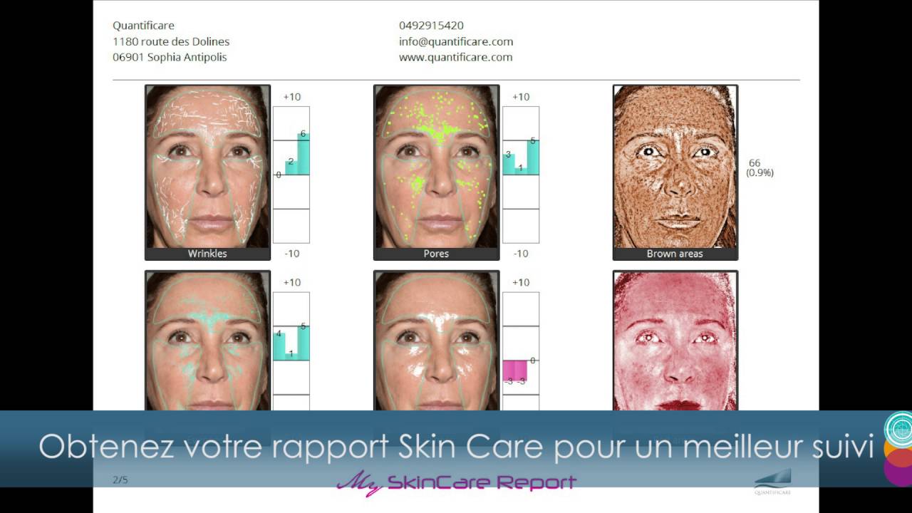 Simulation 3D peau du visage (technologie Quantificare LifeViz) par le Dr Navarro à Aix-en-Provence