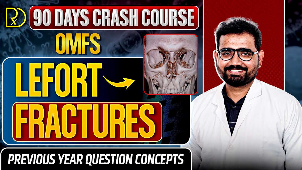 90 Days CRASH COURSE -OMFS -LEFORT FRACTURES-Dr.Vikram C #neet#omfs #medicine#fractures