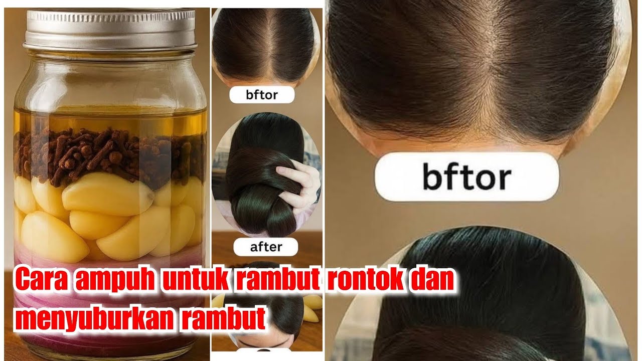Cara ampuh untuk rambut rontok dan menyuburkan rambut