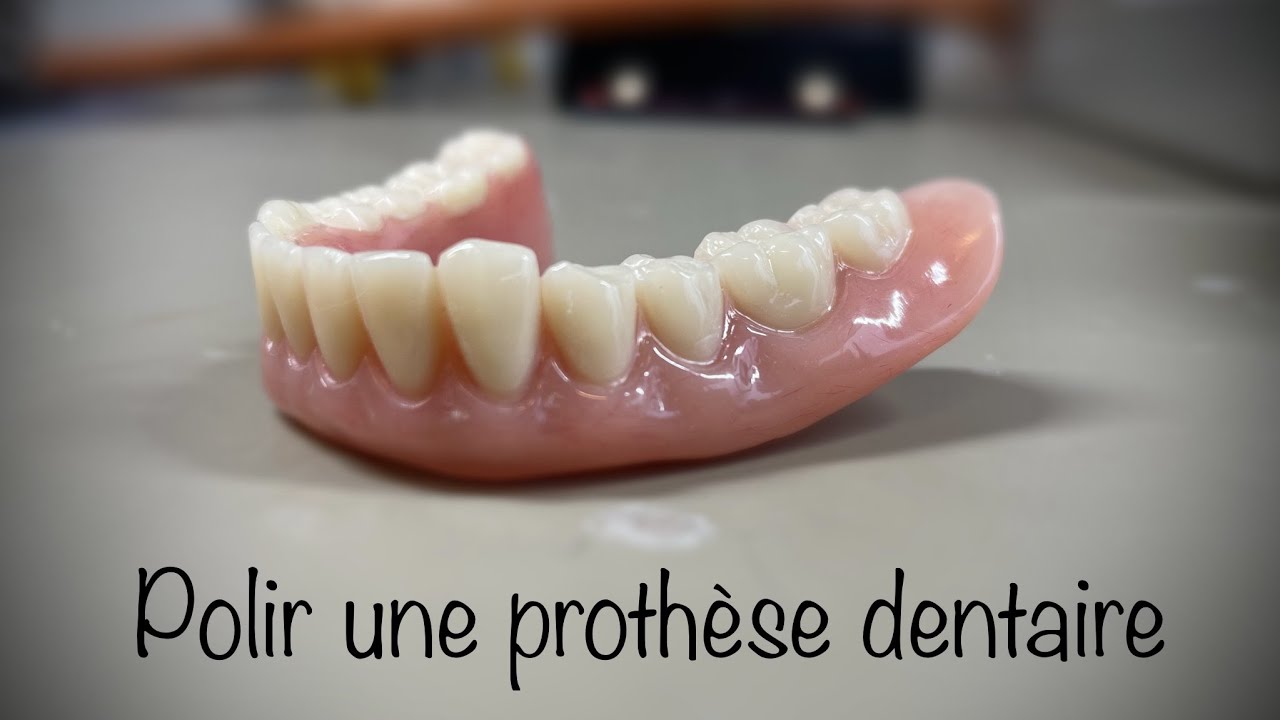 Prothèse dentaire supérieure et inférieure ( finition 'd'une prothèse )