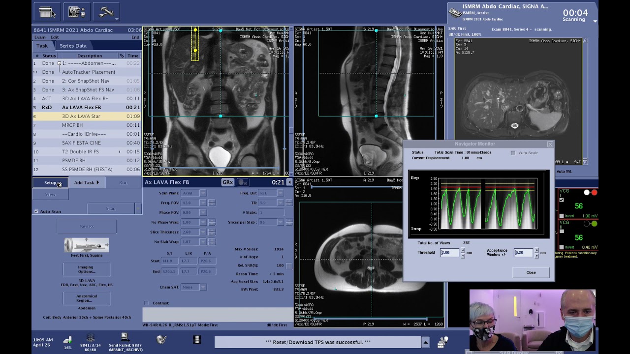 Cardiac and Body Imaging Live Scanning on SIGNA™ Works AIR™ IQ Edition