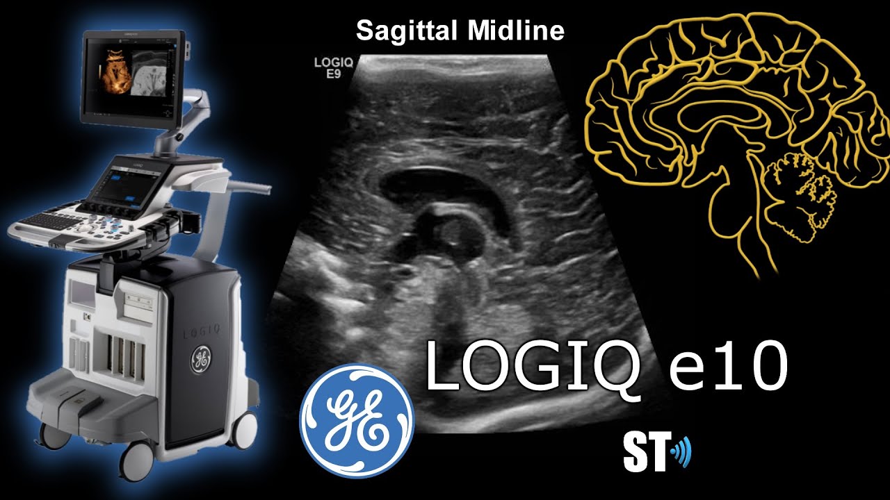 GE Logiq e10 Neurosonography demo and protocol
