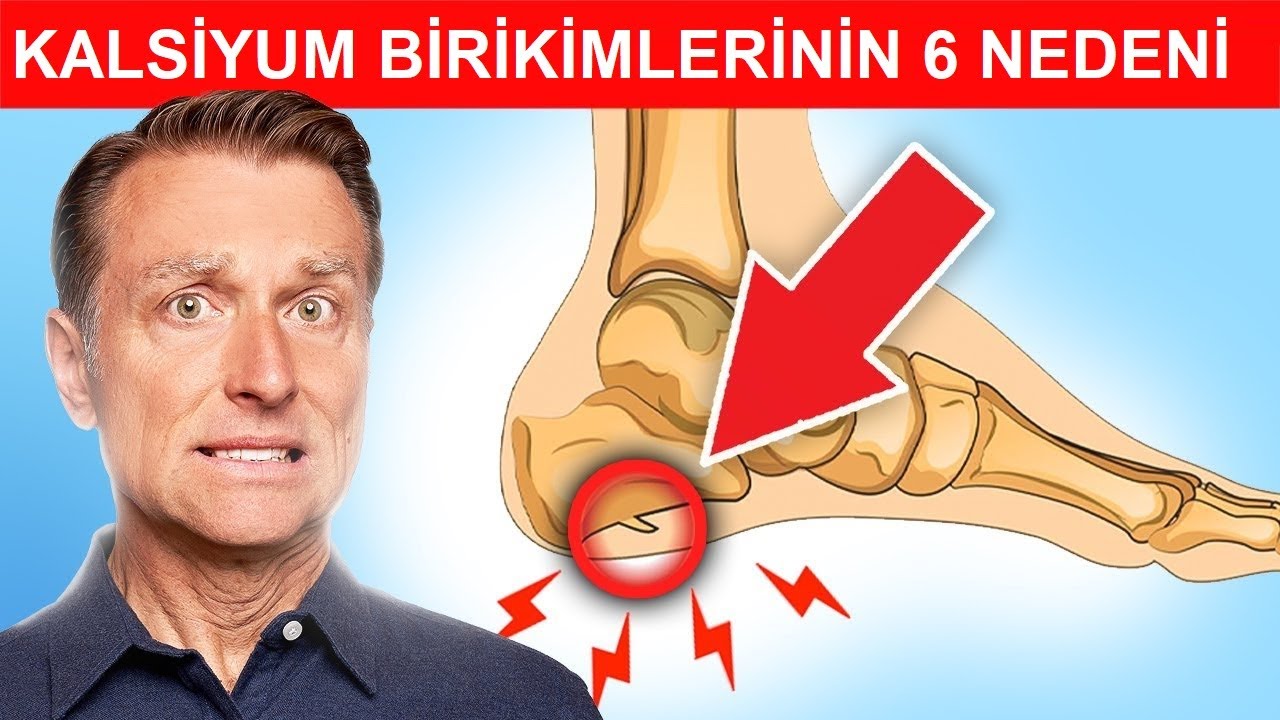 (Mahmuzlar, Osteofitler, Taşlar ve Tartar) Kalsiyum Birikimlerinin 6 Nedeni  | Dr. Berg Türkçe