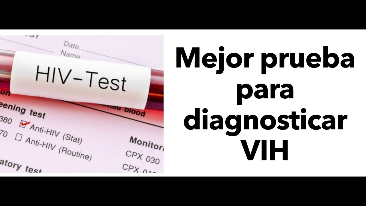 Mejor prueba para diagnóstico de VIH - SIDA