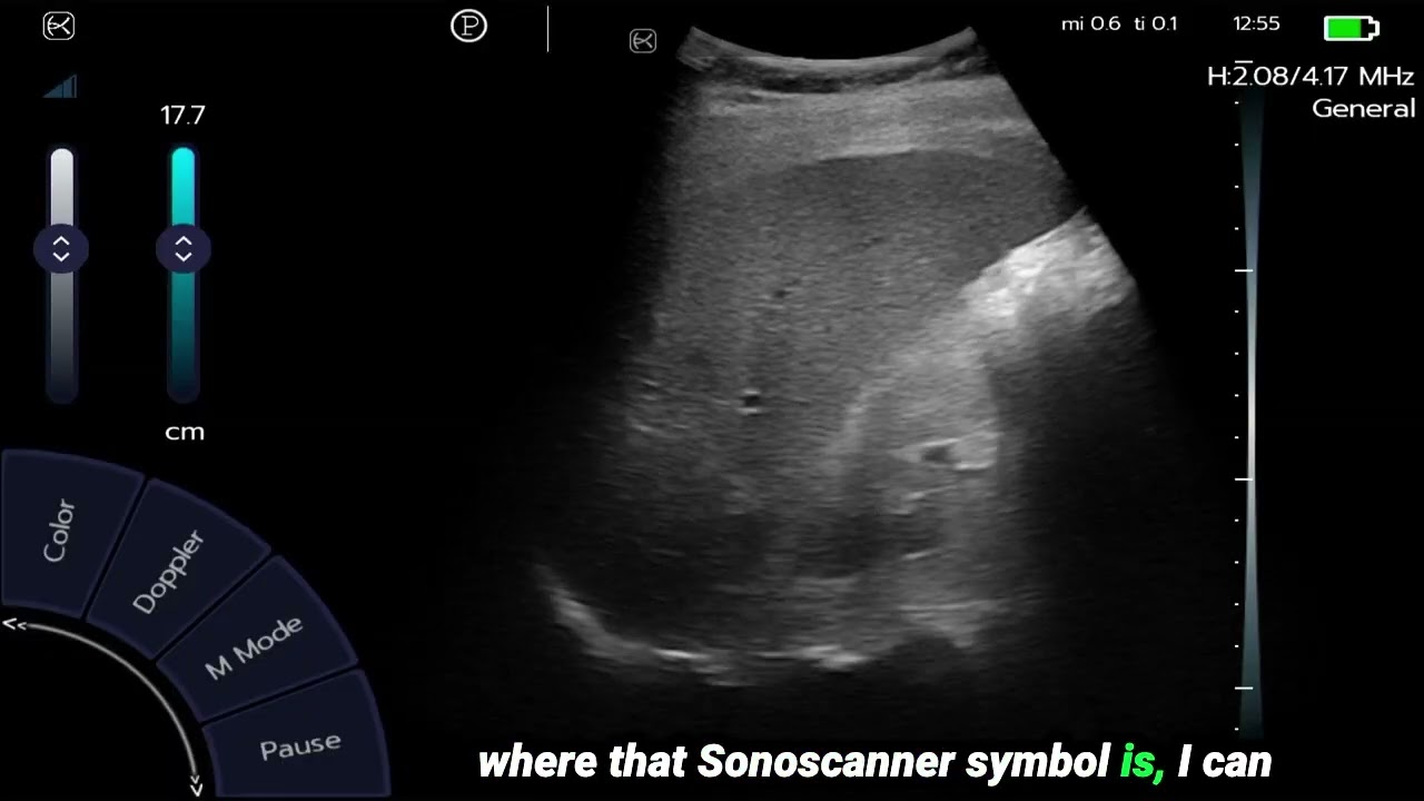 Sonoscanner U-Lite PRO: Full Review by Dr. Josh Guttman from Peachtree POCUS