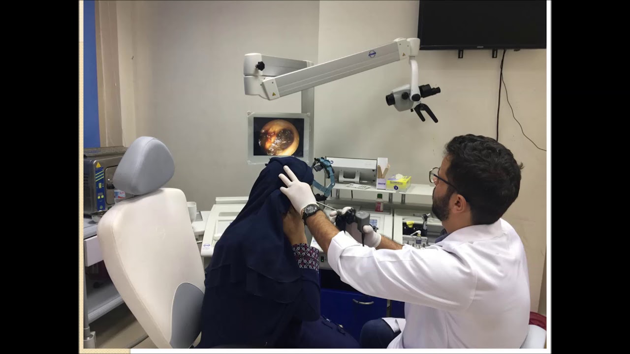 قسم الانف والاذن والحنجره بالمستشفي الجامعي بكفر الشيخ