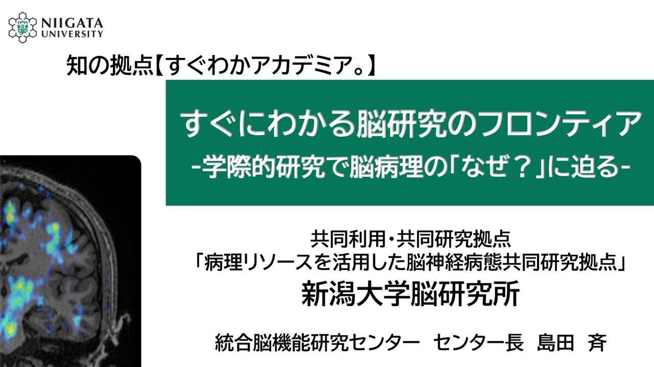 すぐにわかる脳研究のフロンティア -学際的研究で脳病理の「なぜ？」に迫る-