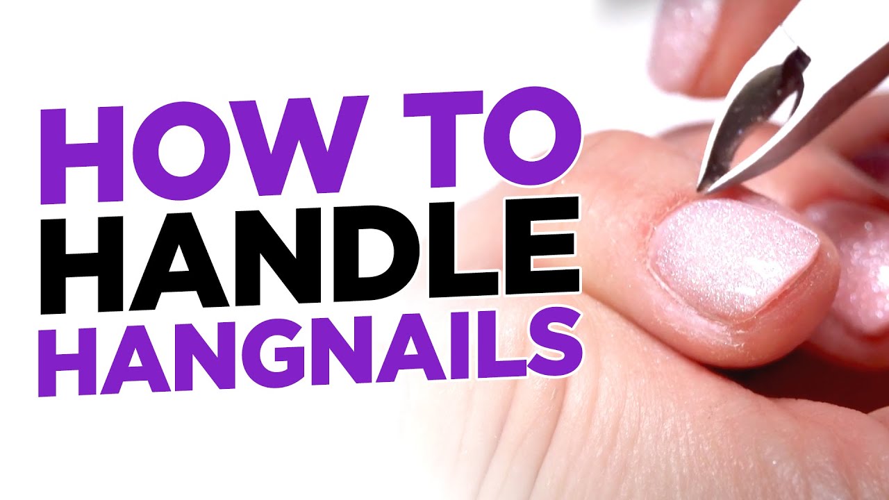 How to Safely Handle Hangnails