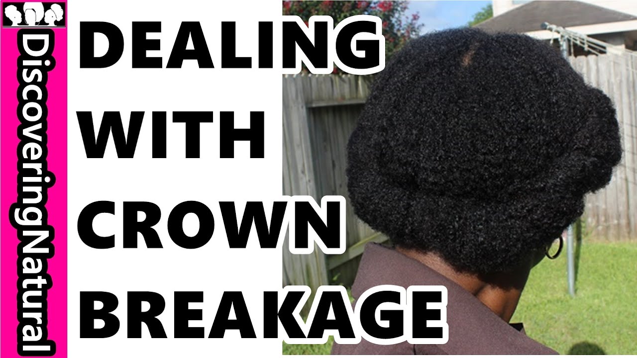 Dealing with Breakage in Crown of Hair and Crown Thinning