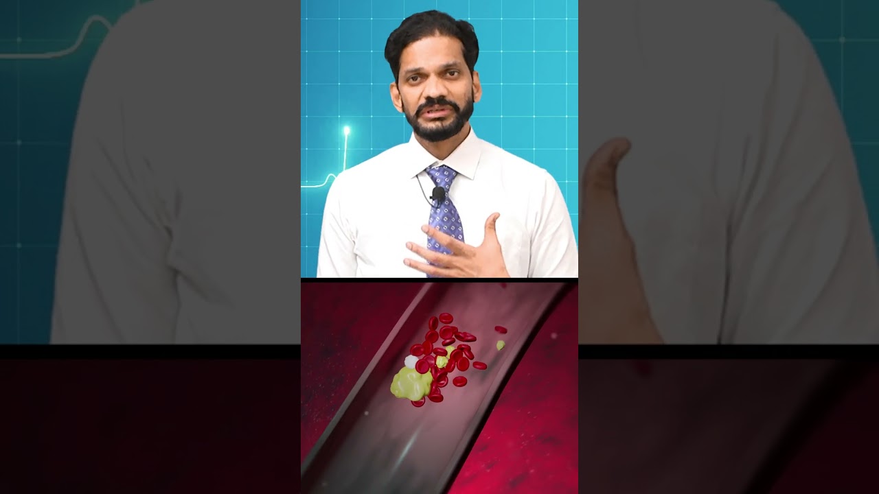 Can medicines cure a heart block instead of a stent or bypass?