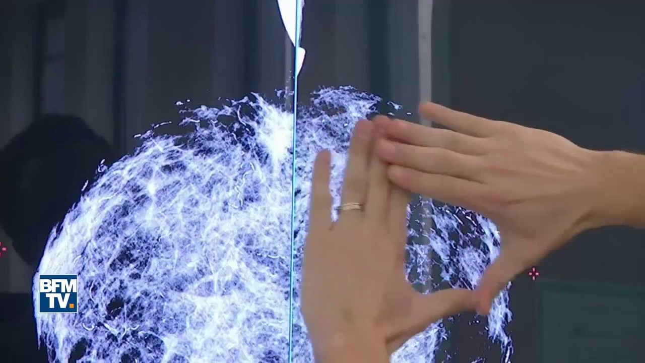 L'intelligence artificielle pour  la détection du cancer du sein