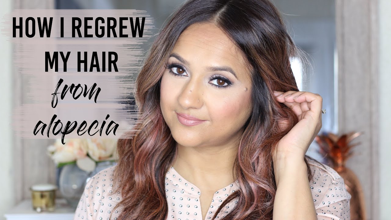 How I Regrew My Hair from Alopecia