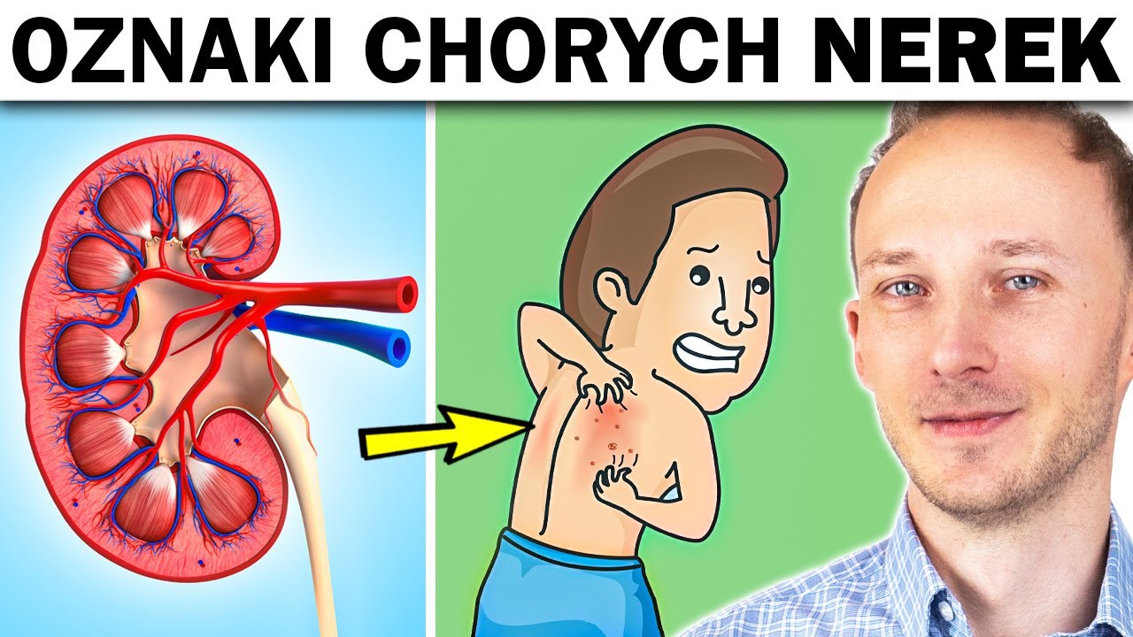 Objawy, że nerki wysiadają - jeśli je masz, zrób TO badanie moczu