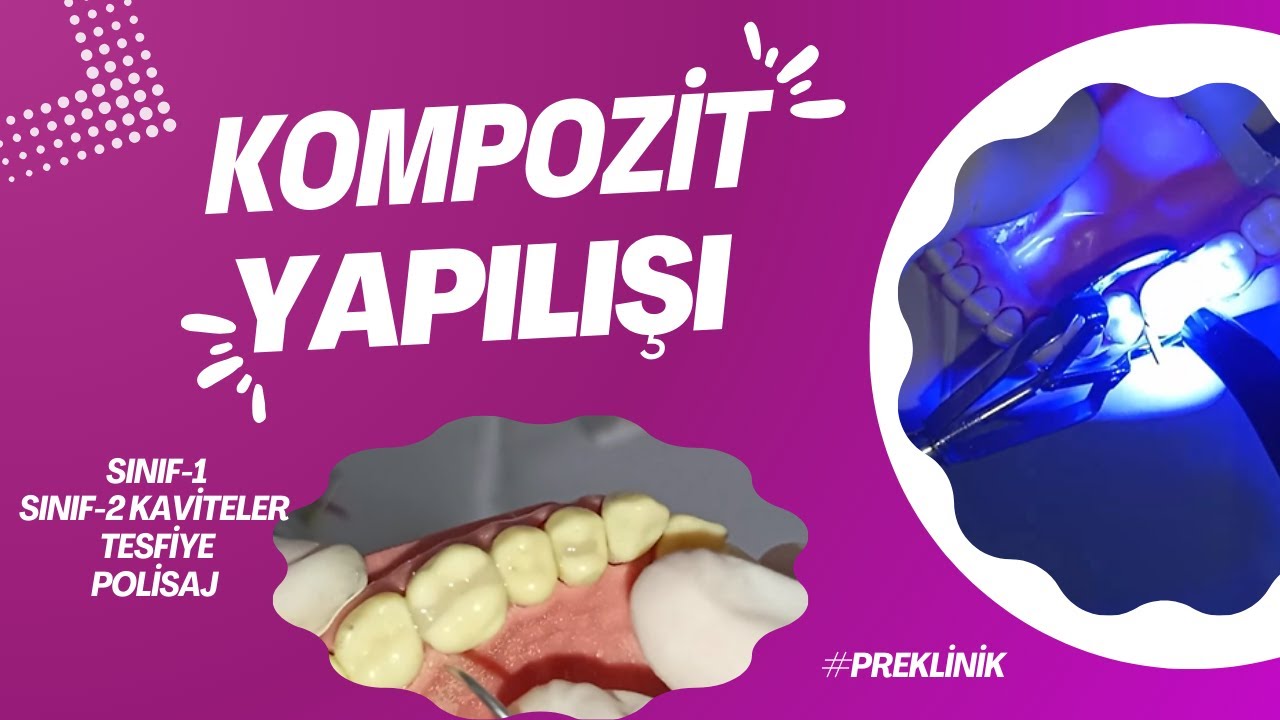 Kompozit Dolgu Yapımı (Sınıf 1-2 Uygulama)