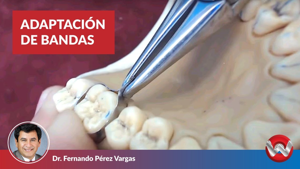 Adaptación de Bandas